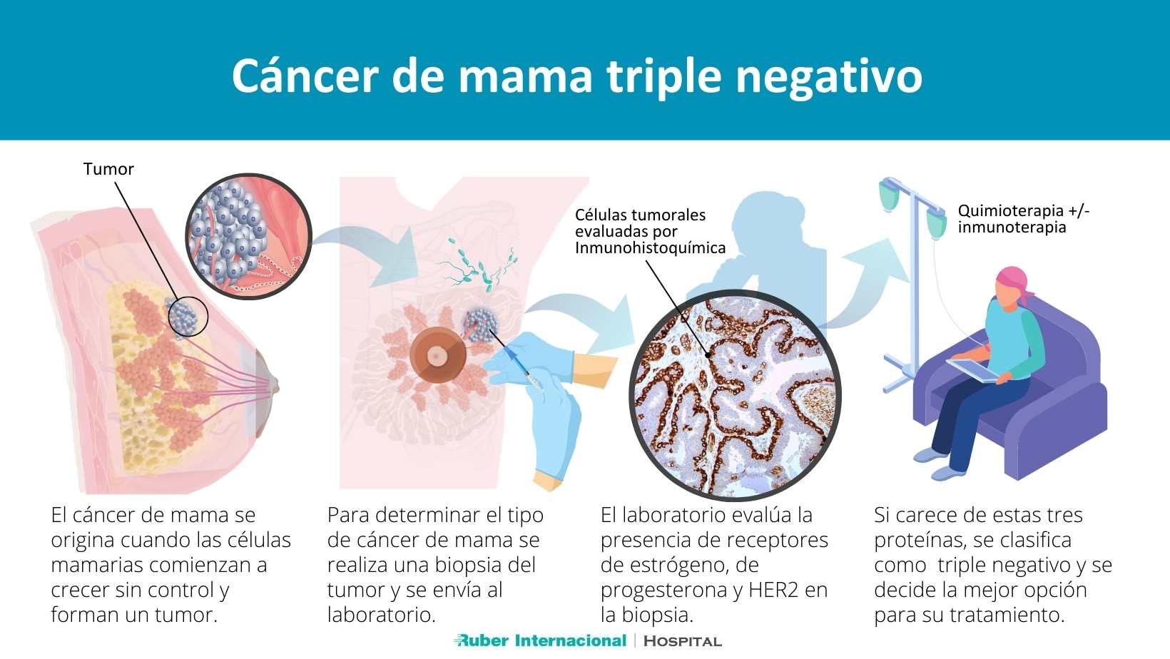 Tratamiento Del Cáncer De Mama 9508